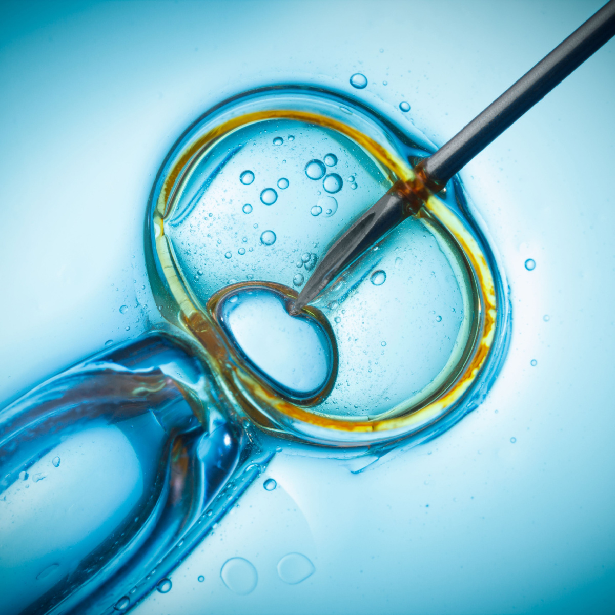 Kingwood IVF myths vs facts